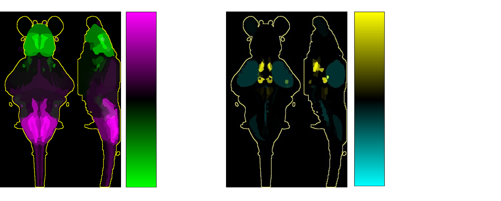 Activity left and structural right brain mapping